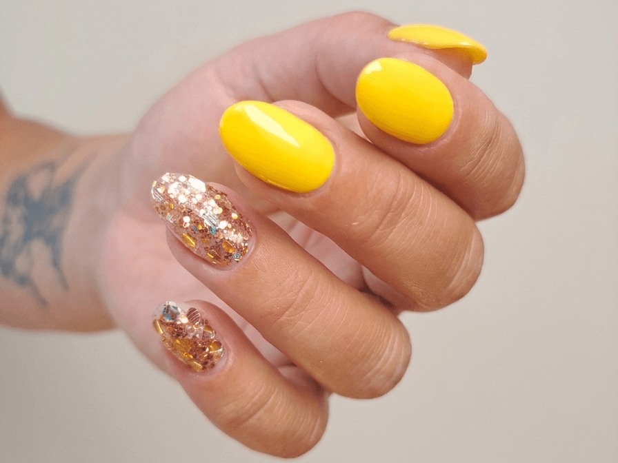 Auffüllen mit Gel oder Polygel